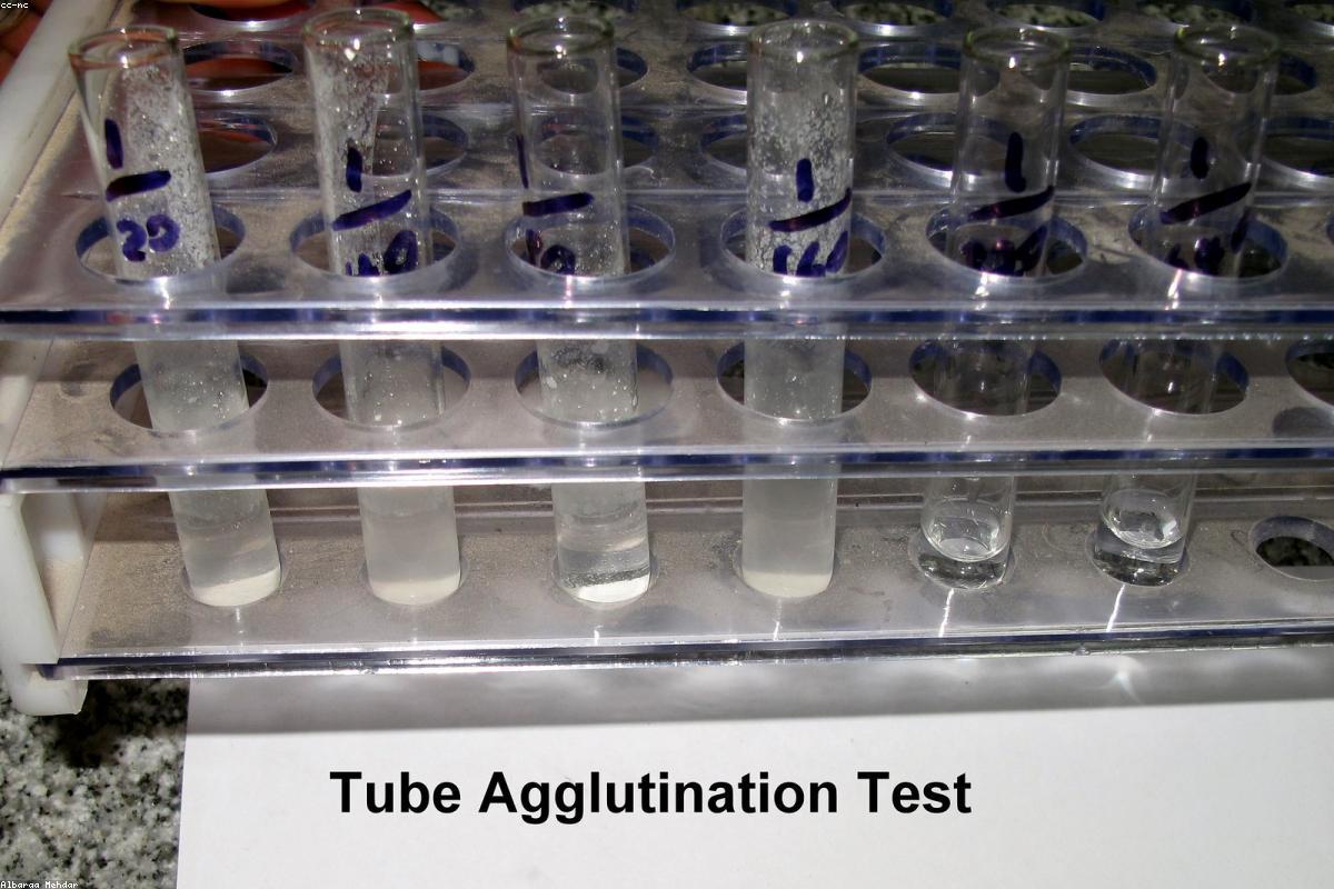Food microbiology testing lab; specialized instrumentation